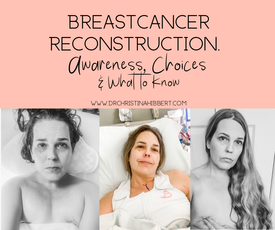 Breast Cancer Reconstruction Awareness, Choices, What to Know
